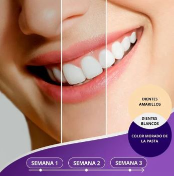 PASTA BLANQUEADORA OBSESSIVE ¡Recupera la confianza en tu sonrisa!