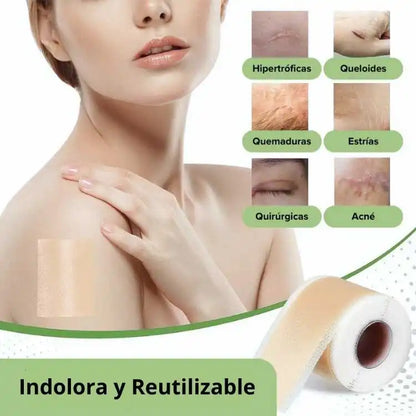 Zhimed™ Rollo Gel Silicona 4cm x 100cm – Cuida y mejora la apariencia de tu piel ✨